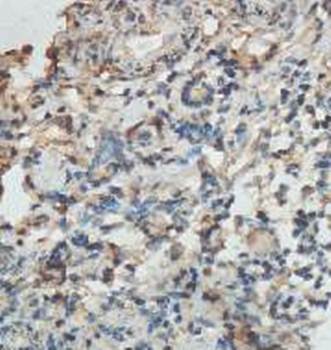 HOOK1 Rabbit Polyclonal Antibody