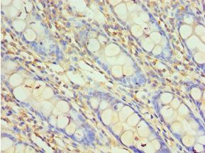 HOXA1 Antibody