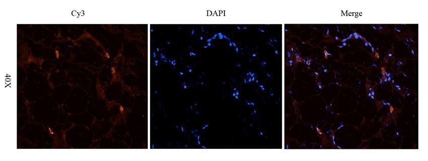 HOXA10 antibody