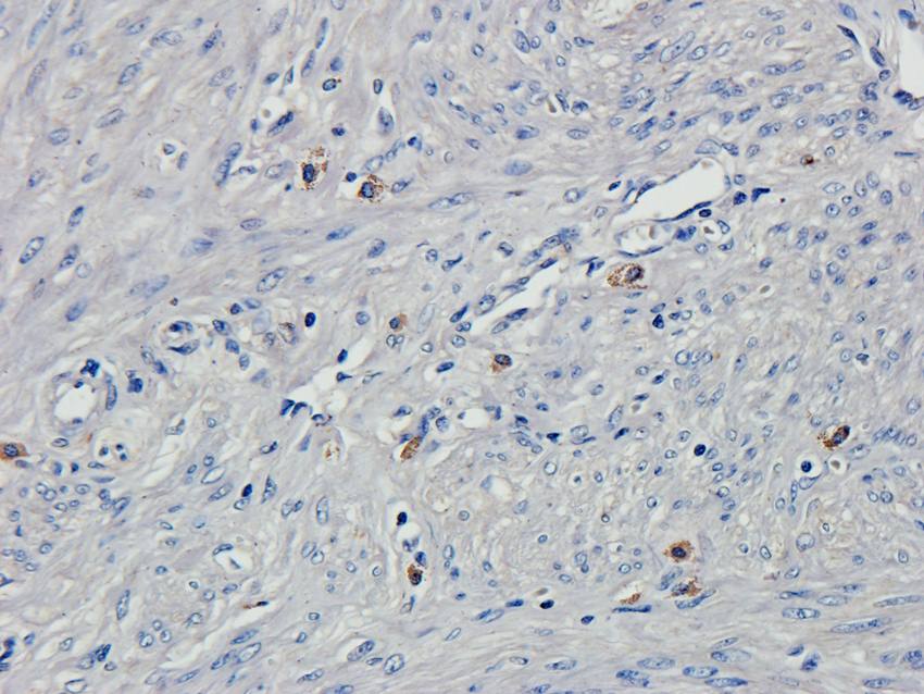 HOXA10 antibody
