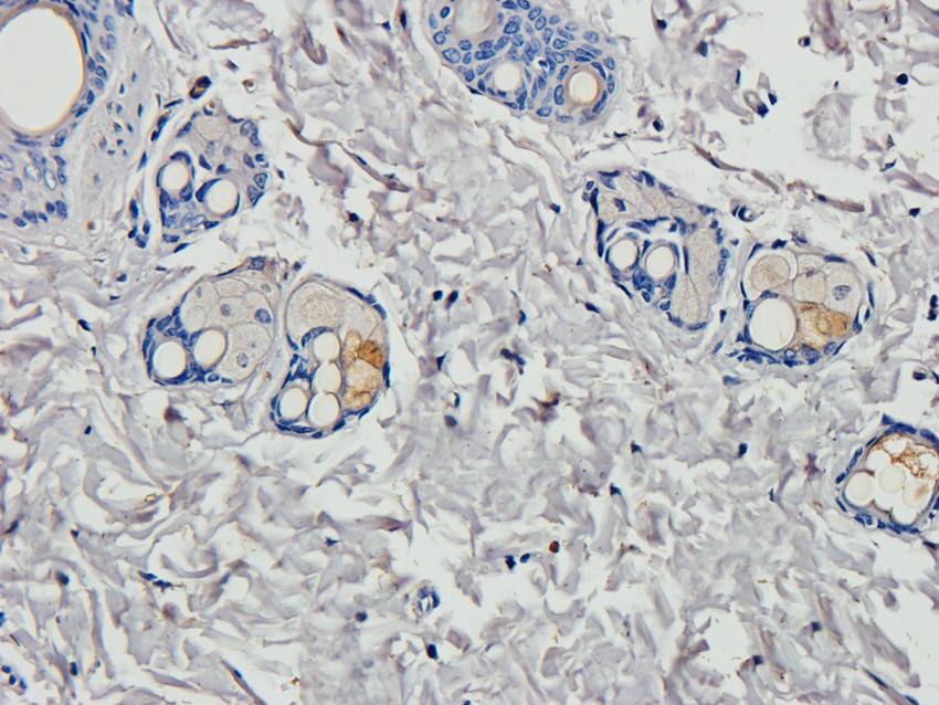 HOXA10 antibody