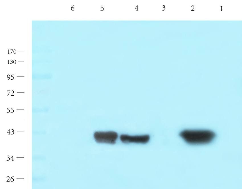 HOXA10 antibody