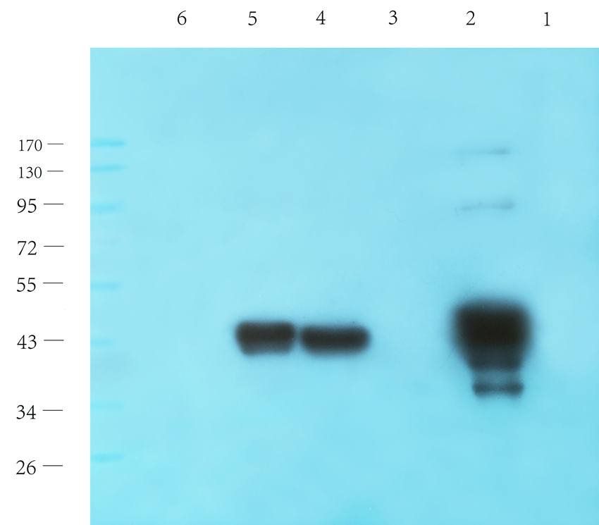 HOXA10 antibody