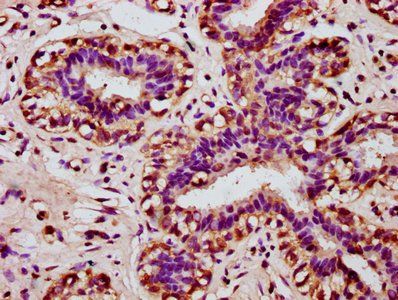 HOXA11 Antibody