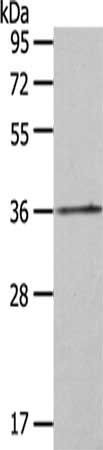 HOXA11 Antibody