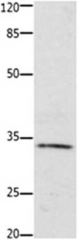 HOXA11 Antibody