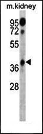 HOXA1 Antibody