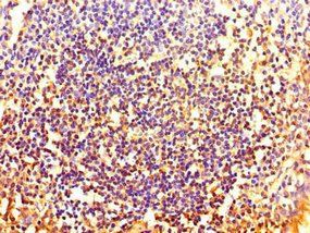 HOXA2 antibody