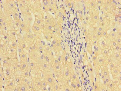 HOXA2 Antibody