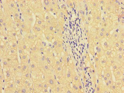 HOXA2 antibody