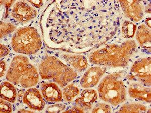 HOXA5 Antibody