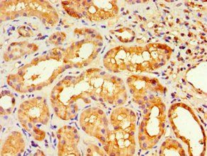 HOXA9 Antibody