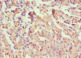 HOXB7 Antibody