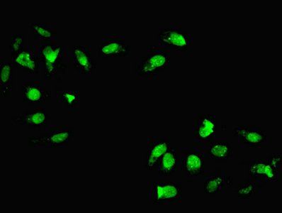 HOXC11 Antibody