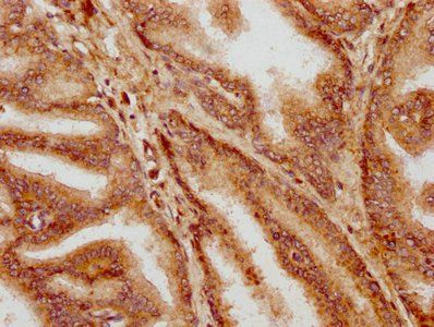 HOXD13 Antibody