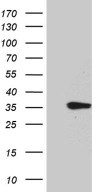 HOXD8 Antibody