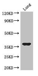 HOXD9 Antibody
