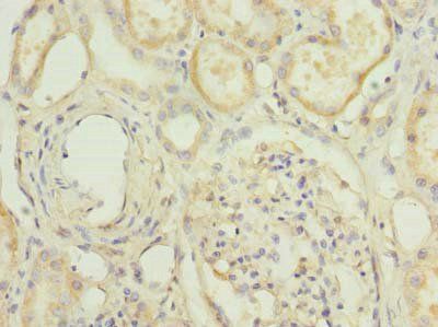 HPCAL1 Antibody