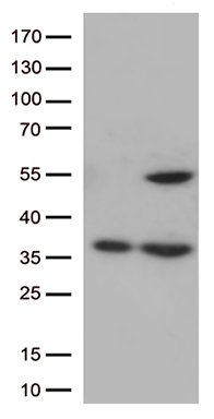 HPCAL4 Antibody