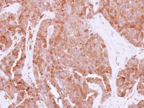 HPRT antibody