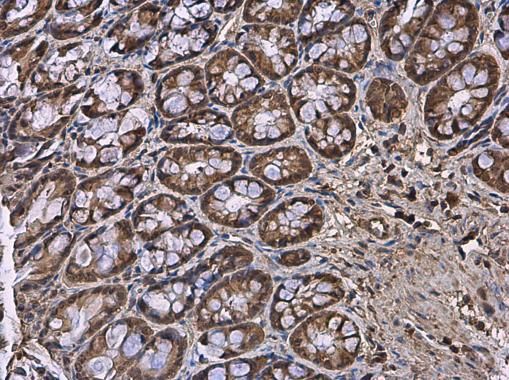 HPRT antibody
