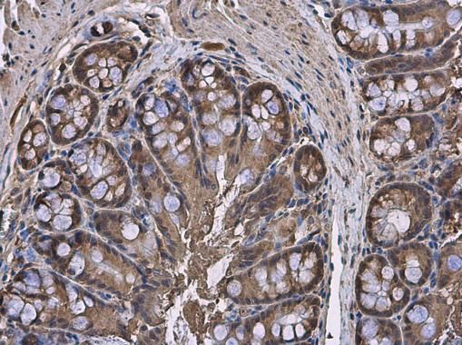 HPRT antibody