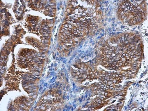 HPRT antibody