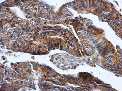 HPRT antibody