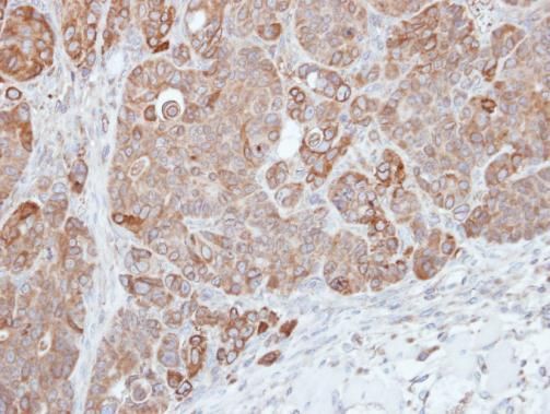 HPS3 antibody [C3], C-term