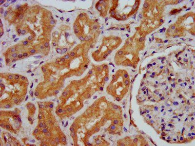 HPS6 Antibody