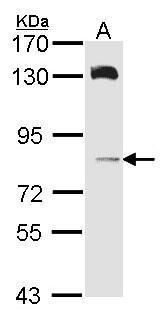 TRAK2 antibody