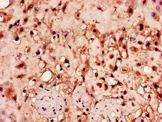 HPSE Antibody