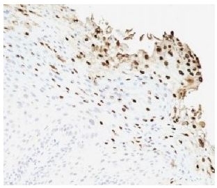 HPV-16 E6 antibody