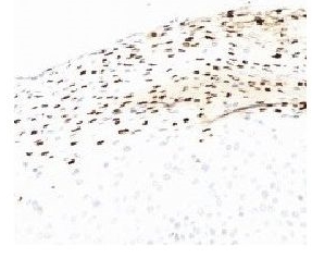 Mouse anti-HPV-16 E6, clone HPV-4B12 (Monoclonal)