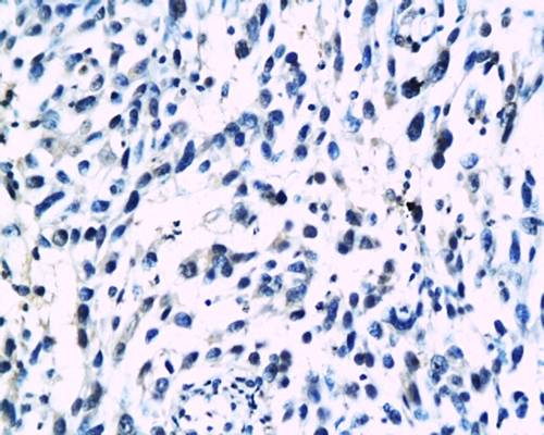 HPV18 E6 protein Rabbit Polyclonal Antibody