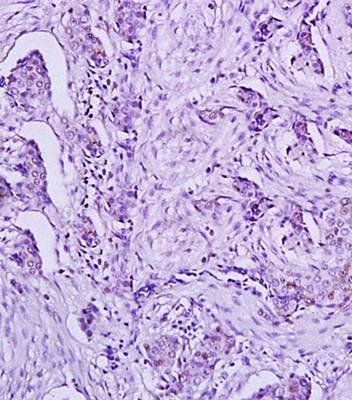 HPV18 E6 protein Rabbit Polyclonal Antibody