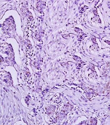 HPV18-E6/E6 antibody