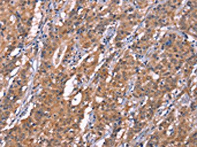 HRASLS2 Antibody