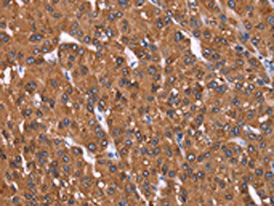 HRASLS2 Antibody