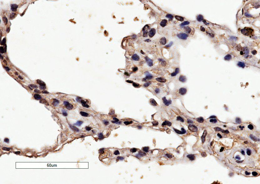 Goat anti-Histamine receptor H1(internal) Antibody