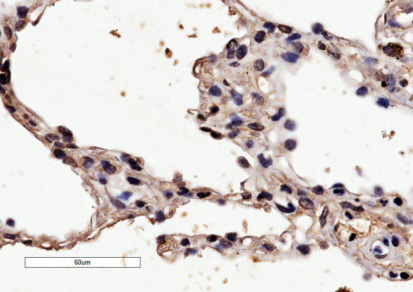 HRH1 antibody