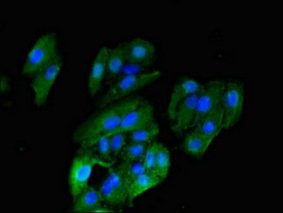 HRH1 Antibody