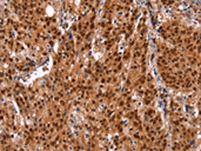 HRK Antibody