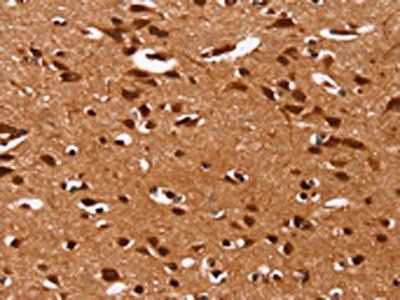 HRK Antibody