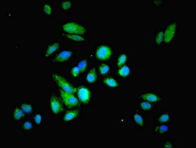 HRSP12 antibody