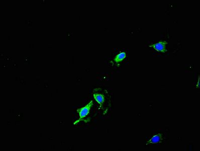 HRSP12 antibody