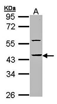 HS1BP3 Rabbit Polyclonal Antibody