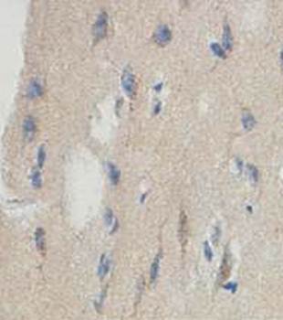 HS1BP3 Rabbit Polyclonal Antibody