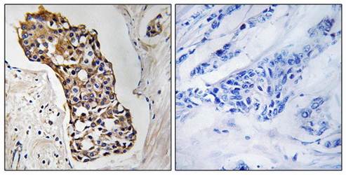 HSD11B1 Antibody