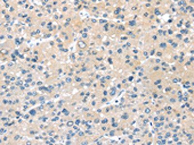 HSD11B2 Antibody